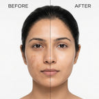Niacinamide 10% Face Serum | Oil Balance & Smooth Skin | For Oily & Combination Skin Type | 30 ml